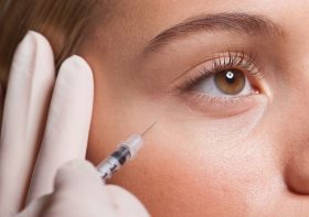 Can bad dermal fillers be resolved?